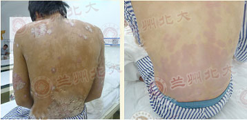 ���ݱ���Ƥ����