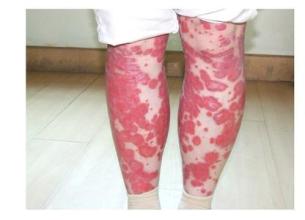 ���ݱ���Ƥ����